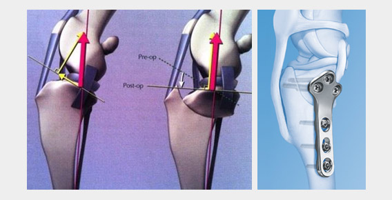 Traitement d'une rupture ligamentaire du chien
